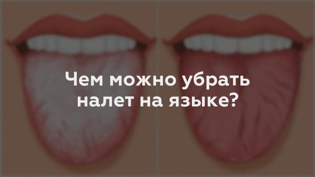 Чем можно убрать налет на языке?