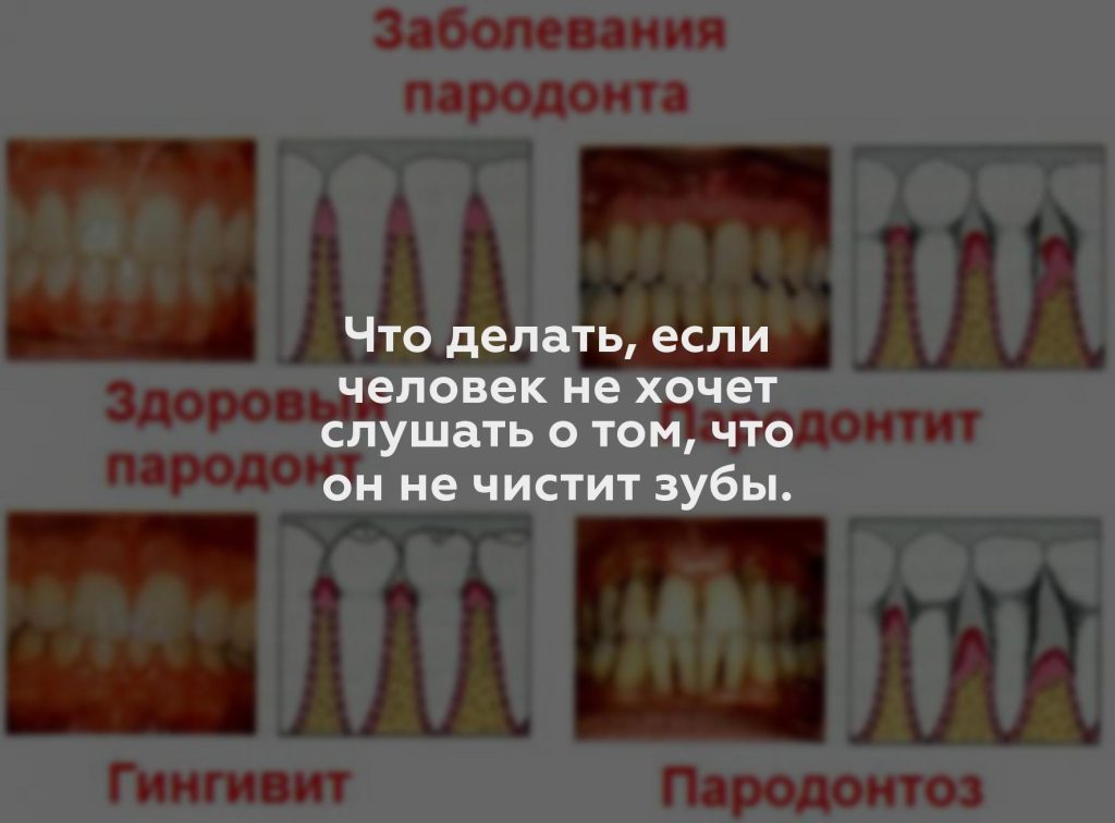 Что делать, если человек не хочет слушать о том, что он не чистит зубы.