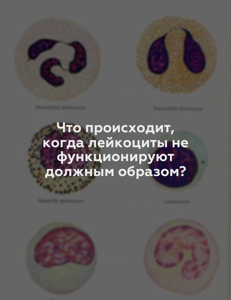 Что происходит, когда лейкоциты не функционируют должным образом?