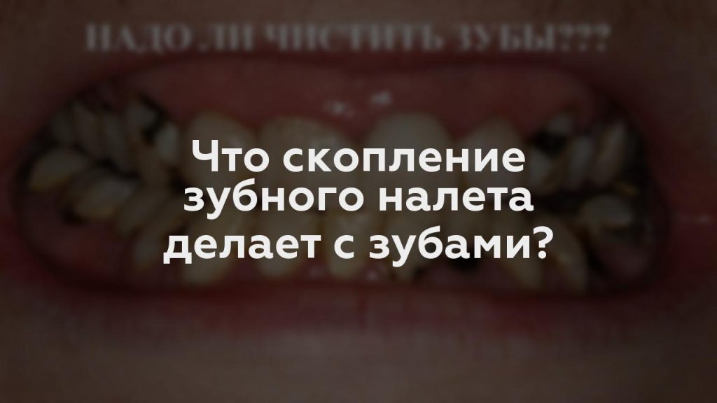 Что скопление зубного налета делает с зубами?