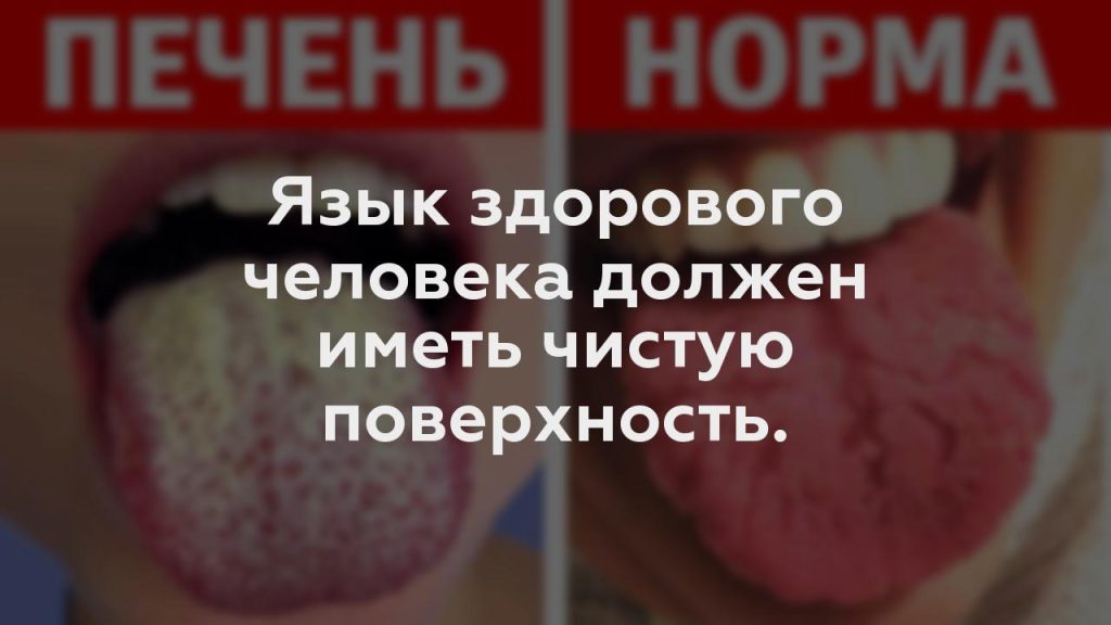 Язык здорового человека должен иметь чистую поверхность.