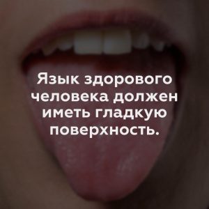 Язык здорового человека должен иметь гладкую поверхность.