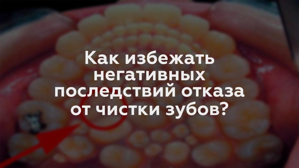 Как избежать негативных последствий отказа от чистки зубов?