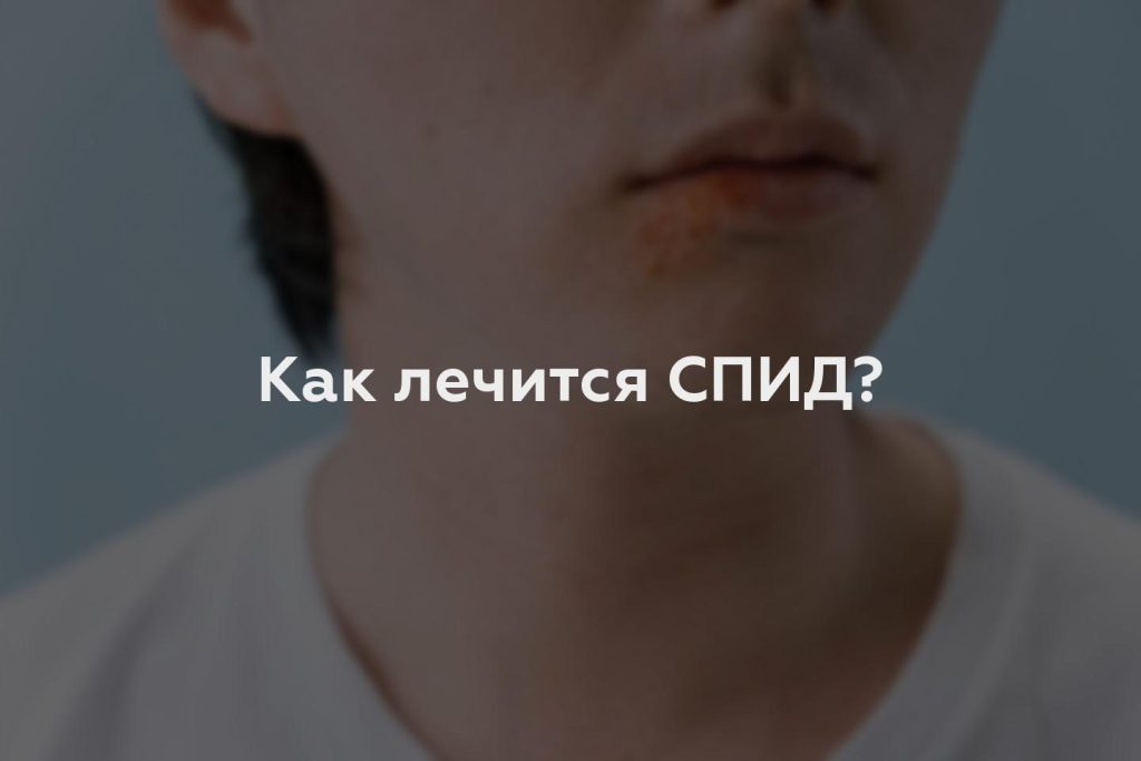 Как лечится СПИД?