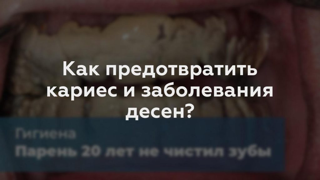 Как предотвратить кариес и заболевания десен?