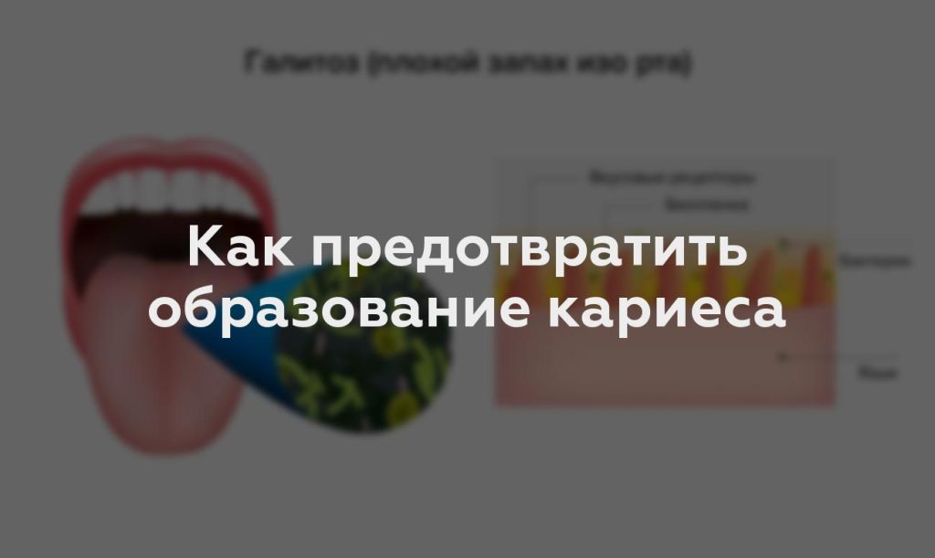 Как предотвратить образование кариеса