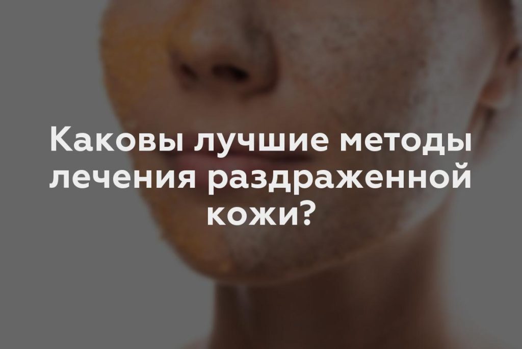 Каковы лучшие методы лечения раздраженной кожи?