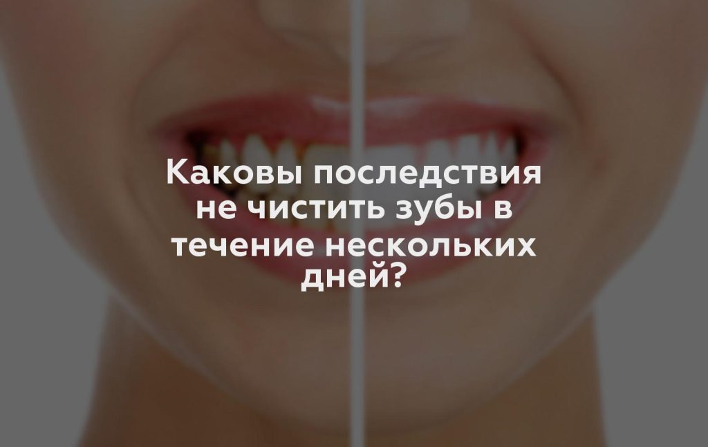 Каковы последствия не чистить зубы в течение нескольких дней?