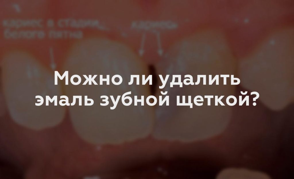 Можно ли удалить эмаль зубной щеткой?