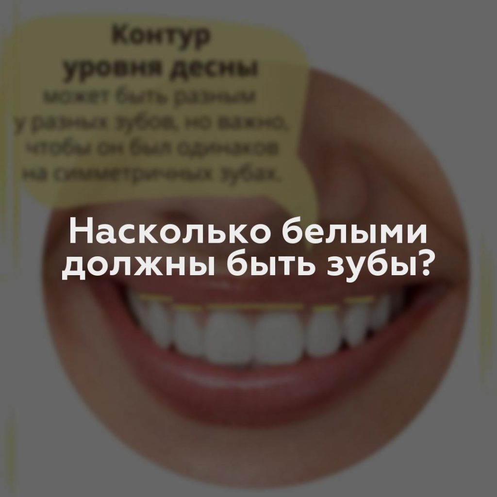 Насколько белыми должны быть зубы?