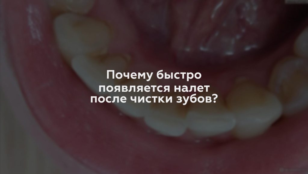 Почему быстро появляется налет после чистки зубов?