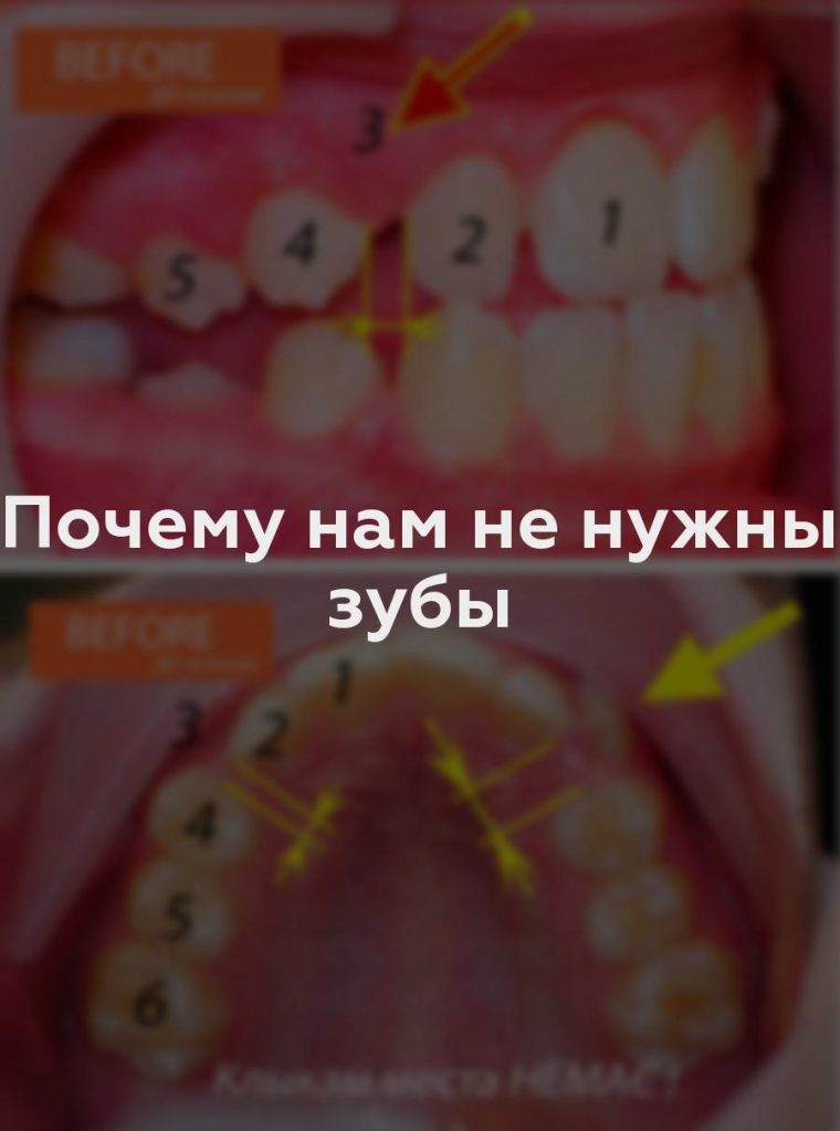 Почему нам не нужны зубы