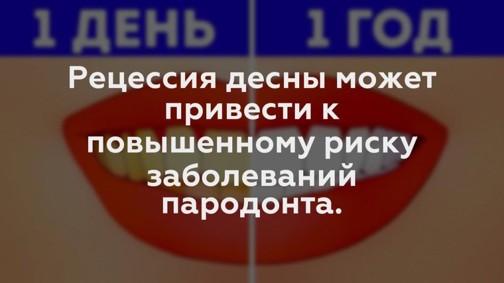 Рецессия десны может привести к повышенному риску заболеваний пародонта.