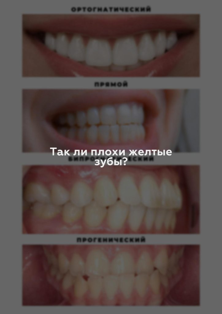 Так ли плохи желтые зубы?