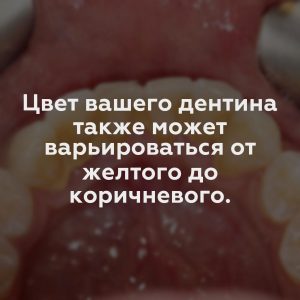 Цвет вашего дентина также может варьироваться от желтого до коричневого.