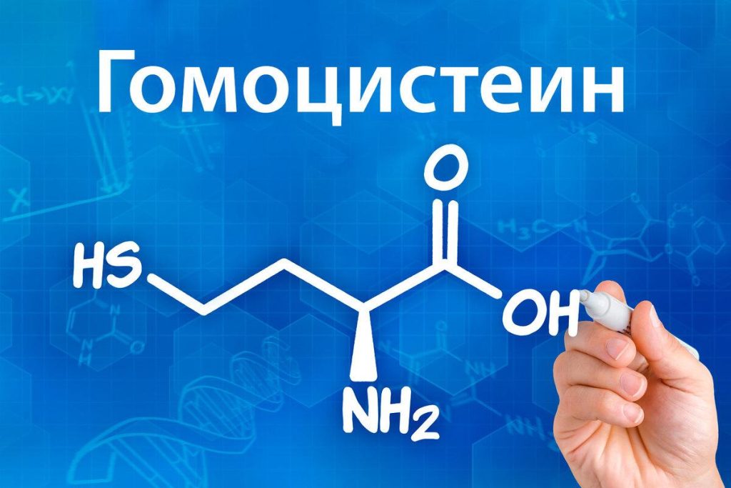 Что определяет анализ гомоцистеина?