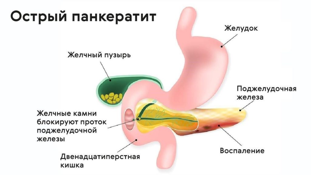 Как можно проверить работу поджелудочной железы?