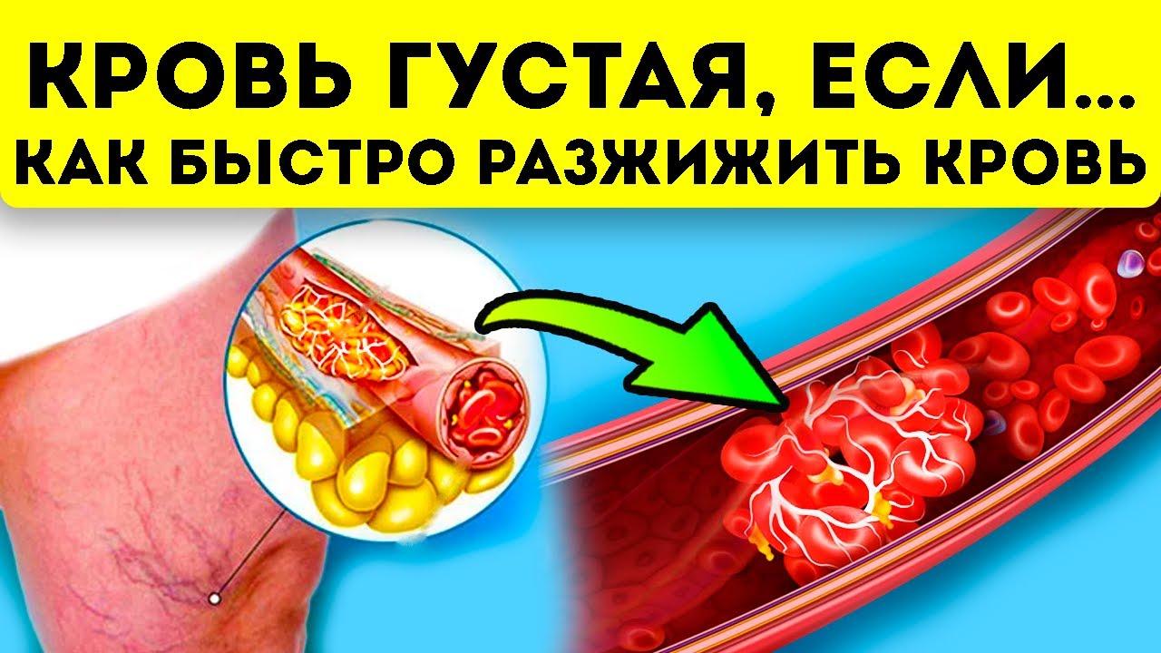 Как по анализу крови определить густоту крови?