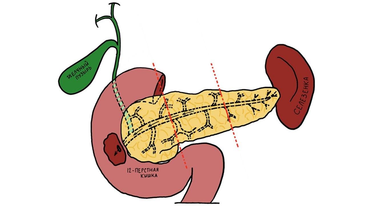 Как понять что поджелудочная не в норме?