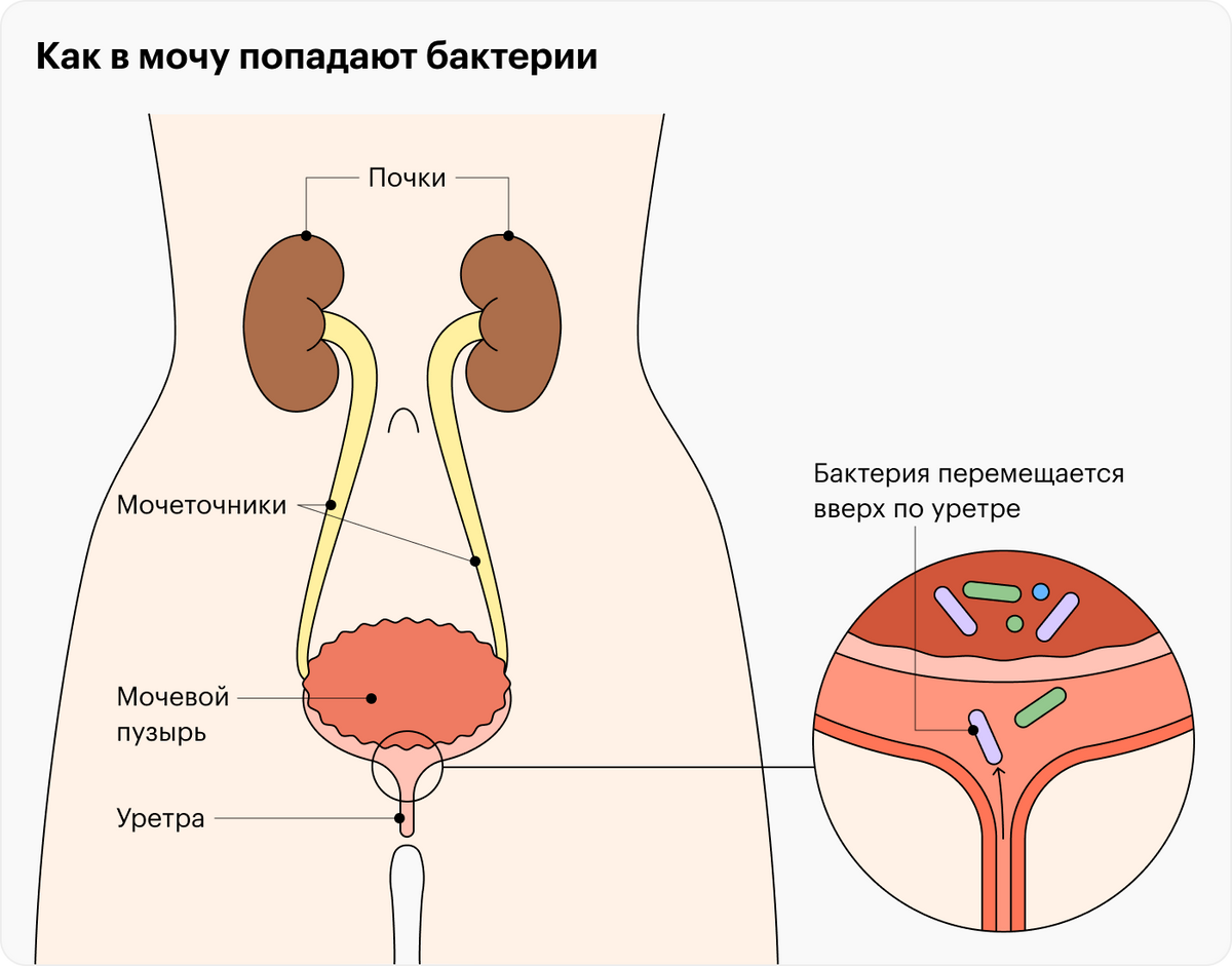 Какие болезни лечит моча?