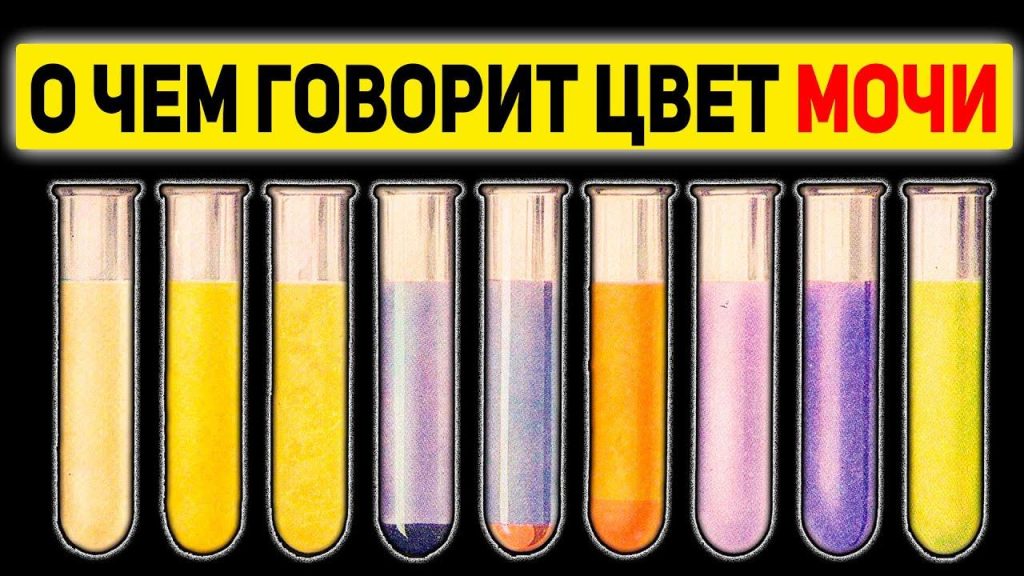 Какой цвет мочи при почечной недостаточности?