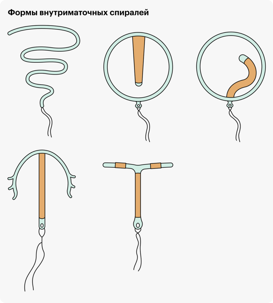 Можно ли не рожавшим девушкам ставить спираль?